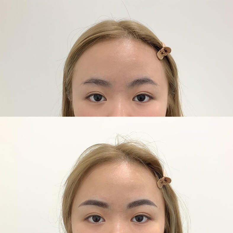 Combo Eyebrow Embroidery 6D Microblading at Bowbowbrow